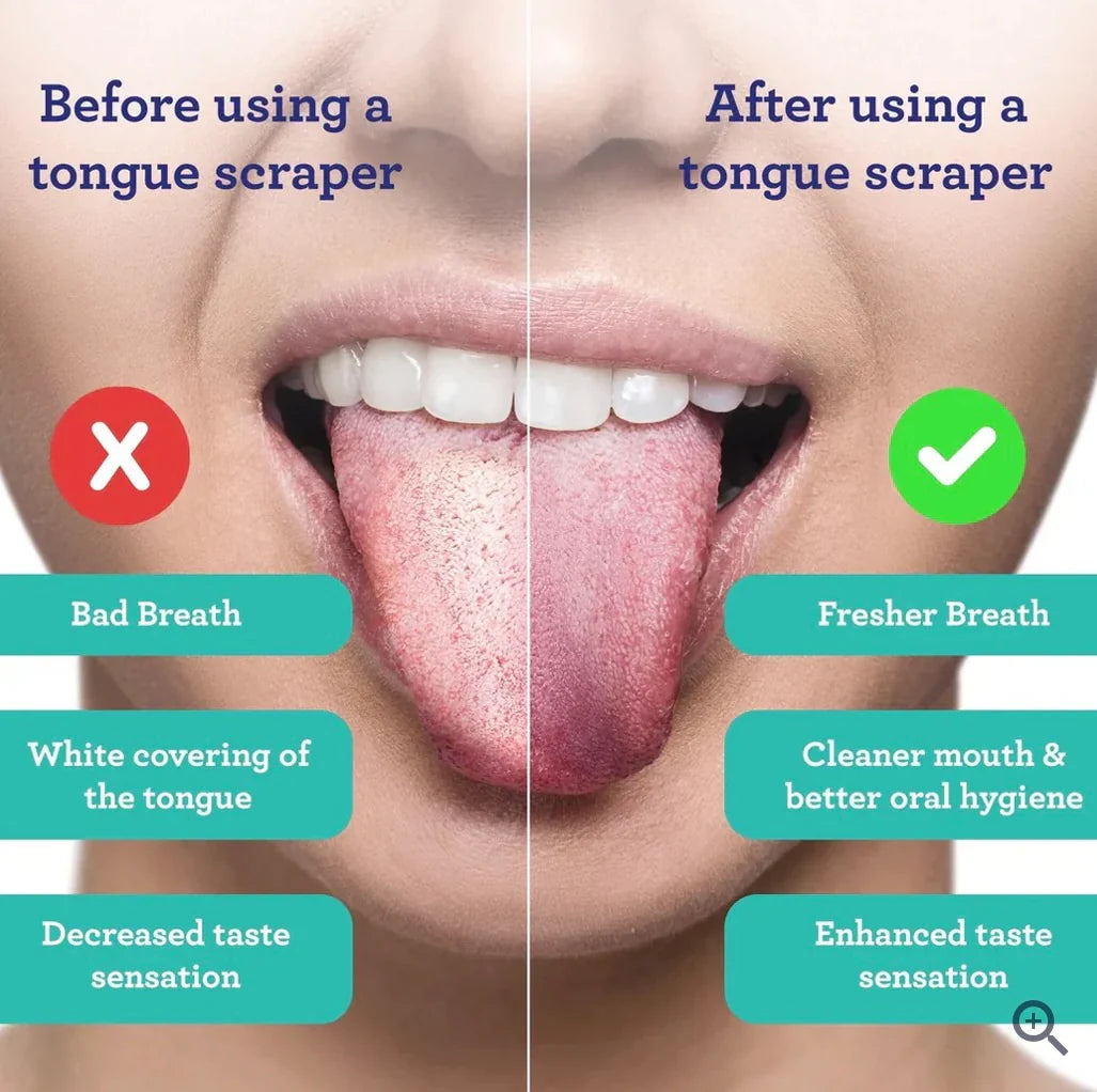 Tongue Scrapers Set (3 Pcs)